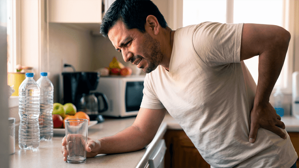 Cálculos renales - síntomas, causas y prevención